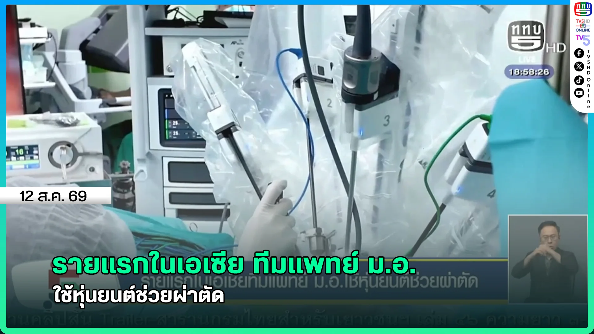 รายแรกในเอเซีย ทีมแพทย์ ม.อ. ใช้หุ่นยนต์ช่วยผ่าตัด