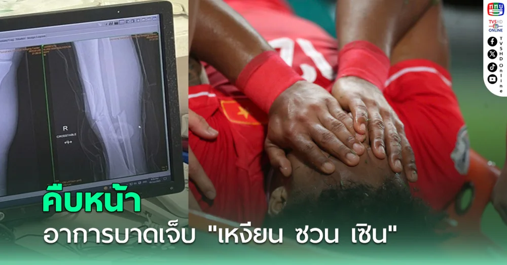 สื่อเวียดนามเผยอาการบาดเจ็บ "เหงียน ซวน เซิน" ดาวยิงตัวเก่ง
