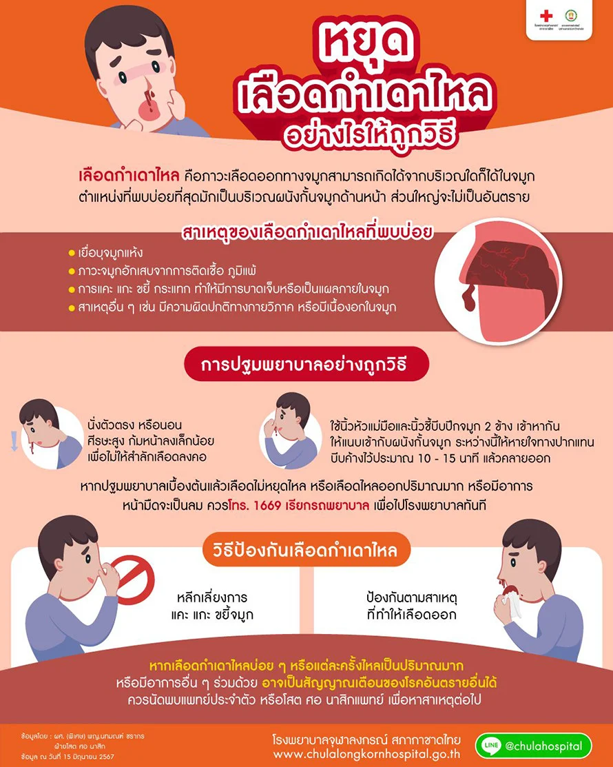 เลือดกำเดาไหล คือ ภาวะเลือดออกทางจมูก ตำแหน่งที่พบบ่อยที่สุด มักเป็นบริเวณผนังกั้นจมูกด้านหน้า