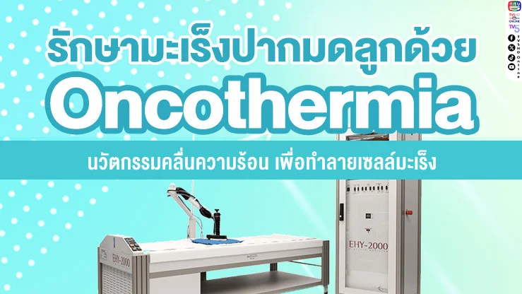 รักษามะเร็งปากมดลูกด้วย Oncothermia นวัตกรรมคลื่นความร้อน เพื่อทําลายเซลล์มะเร็ง